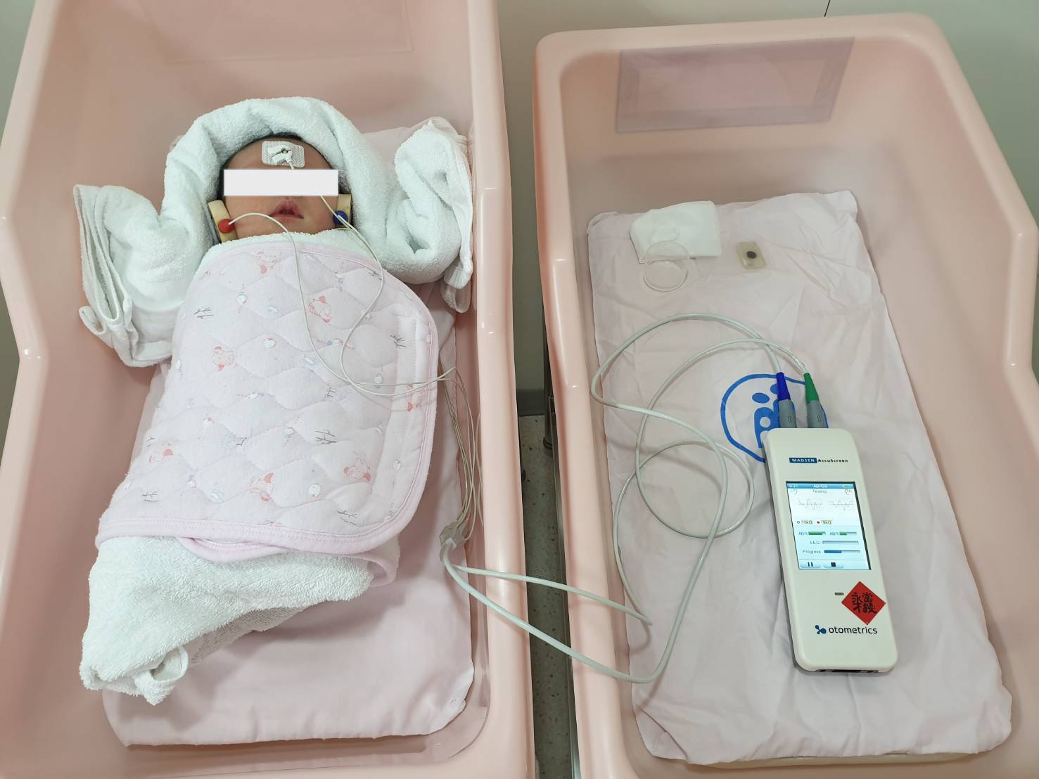 【自由時報】寶寶先天聽損 配戴輔具及早矯正(標題圖檔)