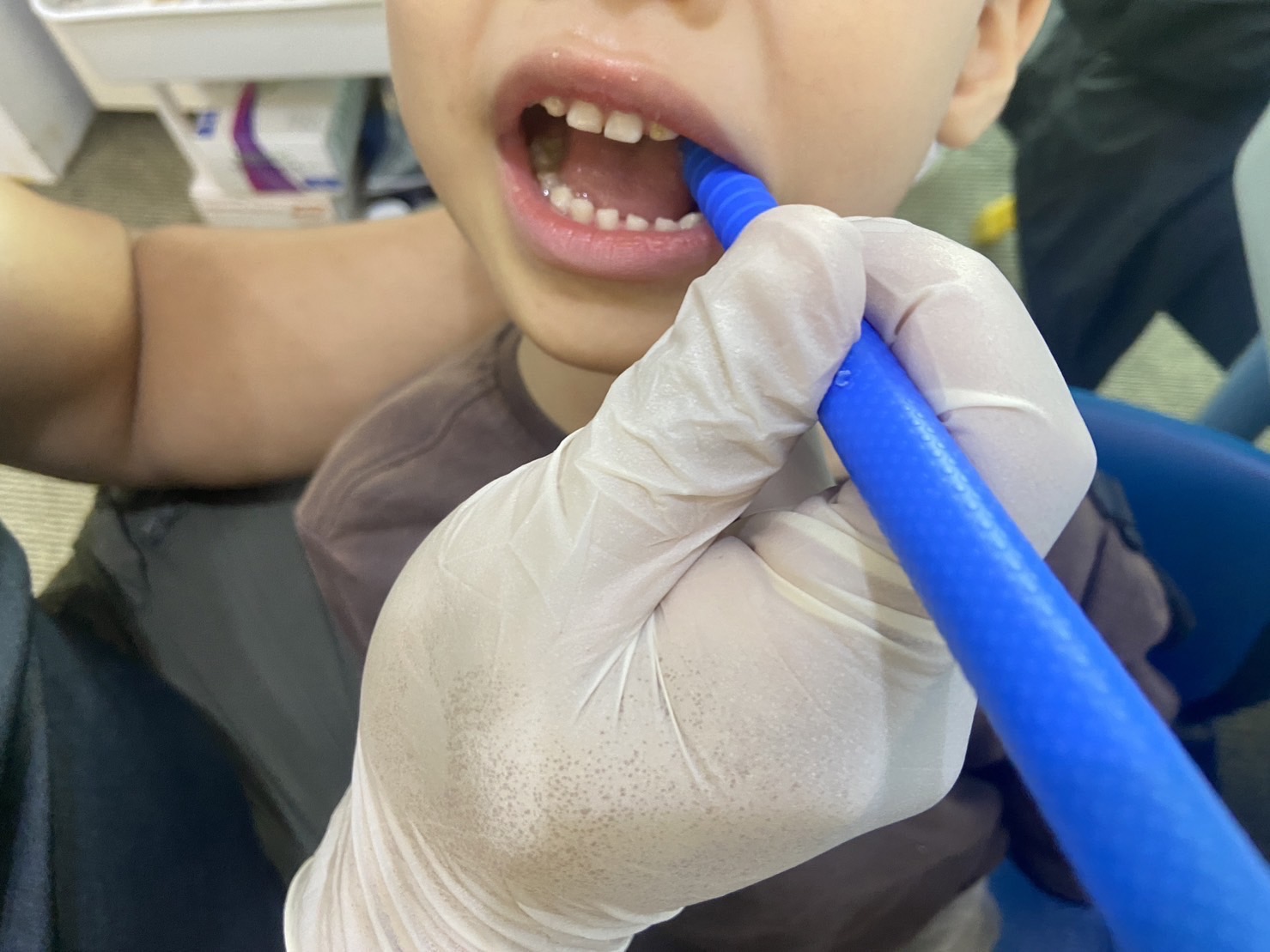 【自由時報】4歲罕病童出生就氣切 徒手治療助學會自主進食(標題圖檔)